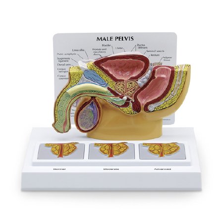 Nasco Male Pelvis With Prostate and BPH Nasco Male