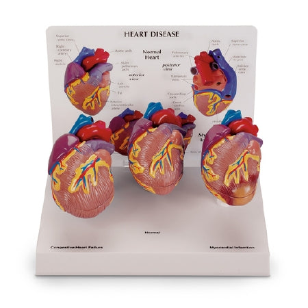 Nasco Heart Models Nasco