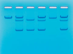 Fisher Scientific Student Lab Activity Edvotek™ Sickle Cell Gene Detection (DNA-based)