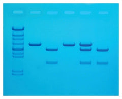 Fisher Scientific Cholesterol Diagnostics Educational Kit Edvotek™ 8 gels, Refrigerated