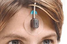 Nonin Medical SpO2 Sensor PureLight® 1 Meter Cord Forehead