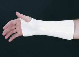 Alimed Cock-Up Wrist Splint with Thumb Hole Pre-Cut Thermoplastic Left or Right Hand White Medium / Large