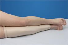 Alimed Protective Leg Tube DermaSaver™ Small