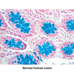 Alcian Blue Stain for Weakly Sulphated Mucins Pint Set ,1 Each - Axiom Medical Supplies