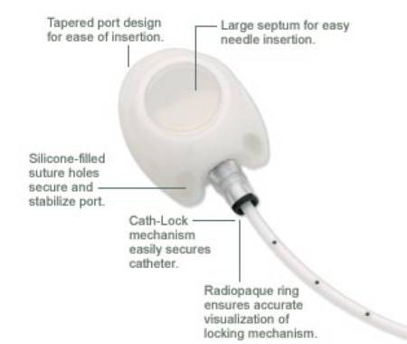 Bard Peripheral Vascular MRI Implantable Port X-Port Isp™ 9.6 Fr. Single Lumen - M-458913-4360 - Each