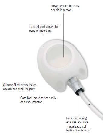 Bard Peripheral Vascular Implantable Port X-Port Isp® - M-697813-2797 - Each