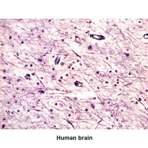 Bodian Stain Kit Alzheimer Control Slides ,Pack oF 25 - Axiom Medical Supplies