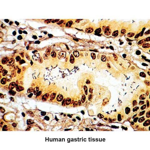 Dieterle Stain Kit Legionella Pneumophila Control Slides ,Pack oF 25 - Axiom Medical Supplies