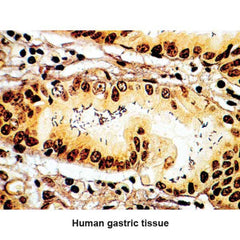 Dieterle Stain Kit Legionella Pneumophila Control Slides ,Pack oF 25 - Axiom Medical Supplies