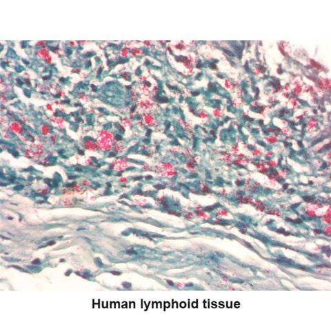 Fite Stain Kit Pint Kit ,1 Each - Axiom Medical Supplies