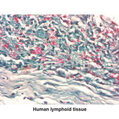 Fite Stain Kit 100mL Kit ,1 Each - Axiom Medical Supplies