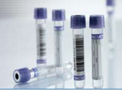 Greiner Bio-One VACUETTE® Venous Blood Collection Tube K3 EDTA Additive 13 X 75 mm 2 mL Lavender / White Ring Pull Cap Polyethylene Terephthalate (PET) Tube