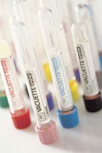 Greiner Bio-One VACUETTE® Venous Blood Collection Tube K2 EDTA Additive 13 X 100 mm 6 mL Lavender / Black Ring Pull Cap Polyethylene Terephthalate (PET) Tube