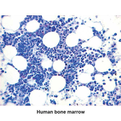 Giemsa-May-Grunwald Stain Kit Mast Cell Control Slides ,Pack oF 25 - Axiom Medical Supplies