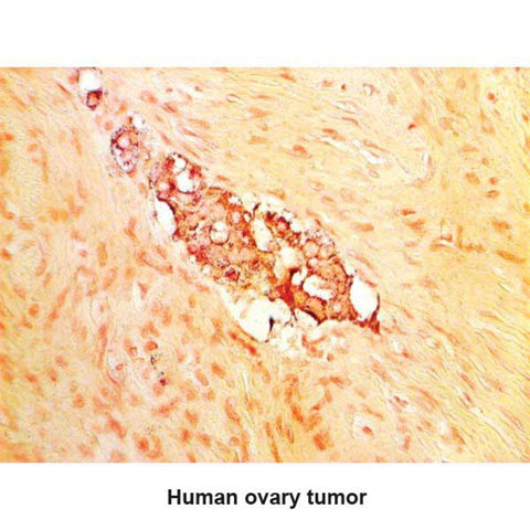 Grimelius Microwave Stain Kit 100mL Kit ,1 Each - Axiom Medical Supplies