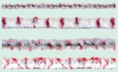 Healthmark Industries Cleaning Brush Flexistem - M-521937-1781 - Roll of 1