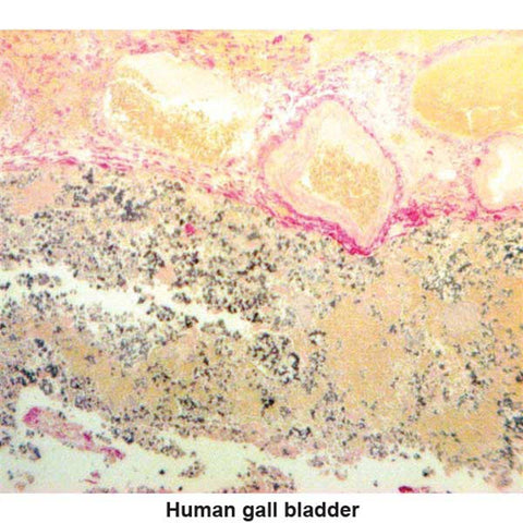 Hall Bile Stain Kit Bile Control Slides ,Pack oF 25 - Axiom Medical Supplies