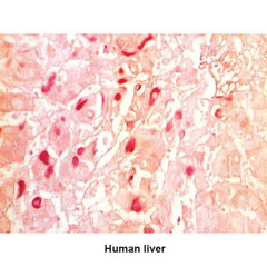 Hepatitis B Stain Kit Small Intestine Control Slides ,Pack oF 25 - Axiom Medical Supplies