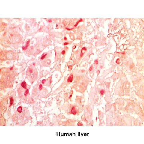 Hepatitis B Stain Kit Hepatitis B Control Slides ,Pack oF 25 - Axiom Medical Supplies