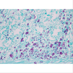 Histopathology Control Slides Fungus • GMS, Aspergillus sp. • Art Pos ,10 / pk - Axiom Medical Supplies