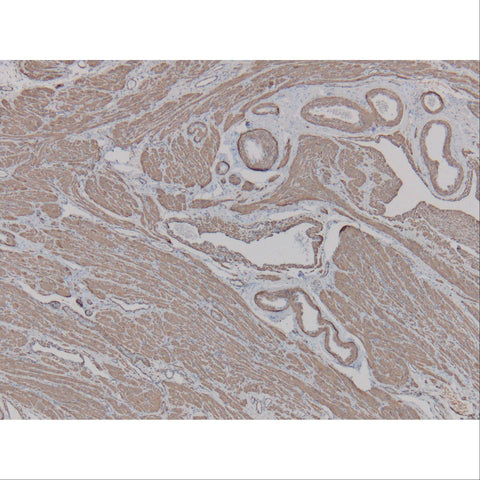 Immunopathology Control Slides Melan-A (MART-1) Pos ,10 / pk - Axiom Medical Supplies