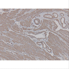 Immunopathology Control Slides Vimentin Pos ,10 / pk - Axiom Medical Supplies