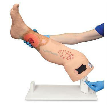 Insufficiency Leg Model Vinnie Venous ,1 Each - Axiom Medical Supplies