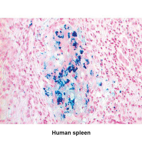 Iron Stain Kit 100mL Set ,1 Each - Axiom Medical Supplies