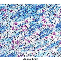 Luxol Fast Blue-CE Violet Kit Central Nervous System Control Slides ,Pack oF 25 - Axiom Medical Supplies