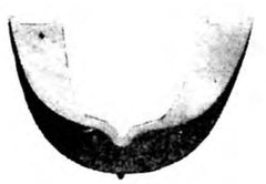 Mercury Medical Teeth Guard Gardent Plastic White