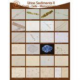 Urine Sediments Posters and Binder Cards Poster II • 19"W x 24"H ,1 Each - Axiom Medical Supplies