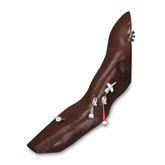 Multiple Replacement Parts for Chester Chest Advanced Arm for Chester Chest ,1 Each - Axiom Medical Supplies