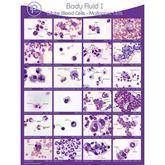 Body Fluid Pathology Reference Poster Body Fluid I: WBCs-Malignant Cells Poster ,1 Each - Axiom Medical Supplies