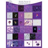 Body Fluid Pathology Reference Poster Body Fluid II: Crystals &amp; Granules Poster ,1 Each - Axiom Medical Supplies