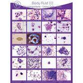 Body Fluid Pathology Reference Poster Body Fluid III: Micro-Lining Cells-Misc Poster ,1 Each - Axiom Medical Supplies