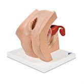 Gynecological Patient Education Model Gynecological Patient Education Model ,1 Each - Axiom Medical Supplies