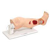 Insufficiency Leg Model Vinnie Venous ,1 Each - Axiom Medical Supplies