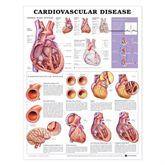 Anatomical Charts Cardiovascular Disease ,1 Each - Axiom Medical Supplies