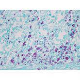 Histopathology Control Slides Acid Fast Bacteria (AFB) Animal Pos ,10 / pk - Axiom Medical Supplies