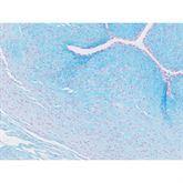 Histopathology Control Slides Alcian Blue pH 2.5 • Umbil Cord Pos C ,10 / pk - Axiom Medical Supplies