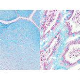 Histopathology Control Slides Alcian Blue pH 2.5 Multi-Tissue Pos ,10 / pk - Axiom Medical Supplies