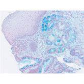 Histopathology Control Slides Alcian Blue pH 2.5 Barrett's Esoph Pos ,10 / pk - Axiom Medical Supplies