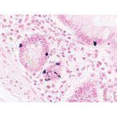 Histopathology Control Slides Argentaffin Pos ,10 / pk - Axiom Medical Supplies