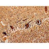 Histopathology Control Slides Bielschowsky Pos ,10 / pk - Axiom Medical Supplies