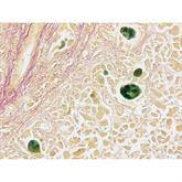 Histopathology Control Slides Bile Pos ,10 / pk - Axiom Medical Supplies