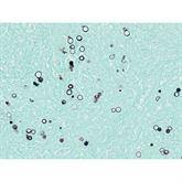 Histopathology Control Slides Blastomyces sp. Pos ,10 / pk - Axiom Medical Supplies