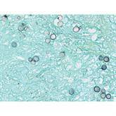 Histopathology Control Slides Blastomyces sp. • Animal Pos ,10 / pk - Axiom Medical Supplies