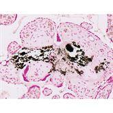 Histopathology Control Slides Calcium Pos ,10 / pk - Axiom Medical Supplies