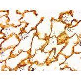 Histopathology Control Slides Cat Scratch Bartonella sp. • Art Pos ,10 / pk - Axiom Medical Supplies