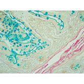 Histopathology Control Slides Colloidal Iron Pos ,10 / pk - Axiom Medical Supplies